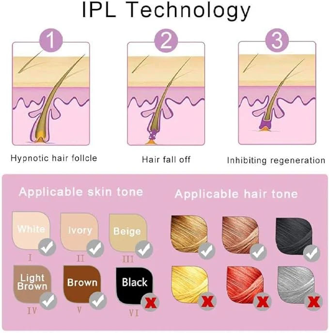 IPL Laser Hair Removal Machine – Smooth Skin Device for Women (Face & Body) 💎